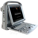 Узи сканер SONOTOUCH 50 CHISON